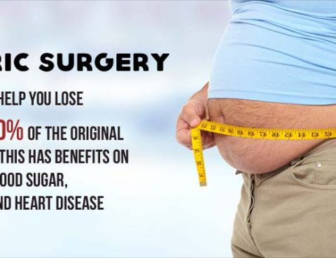 Bariatric-surgery-for-weight-loss Dr venu gopal pareek