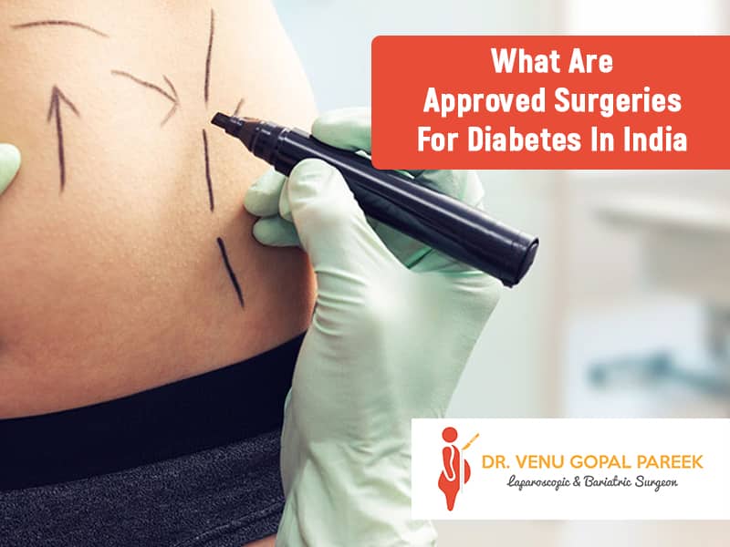 What Are Approved Surgeries For Diabetes In India