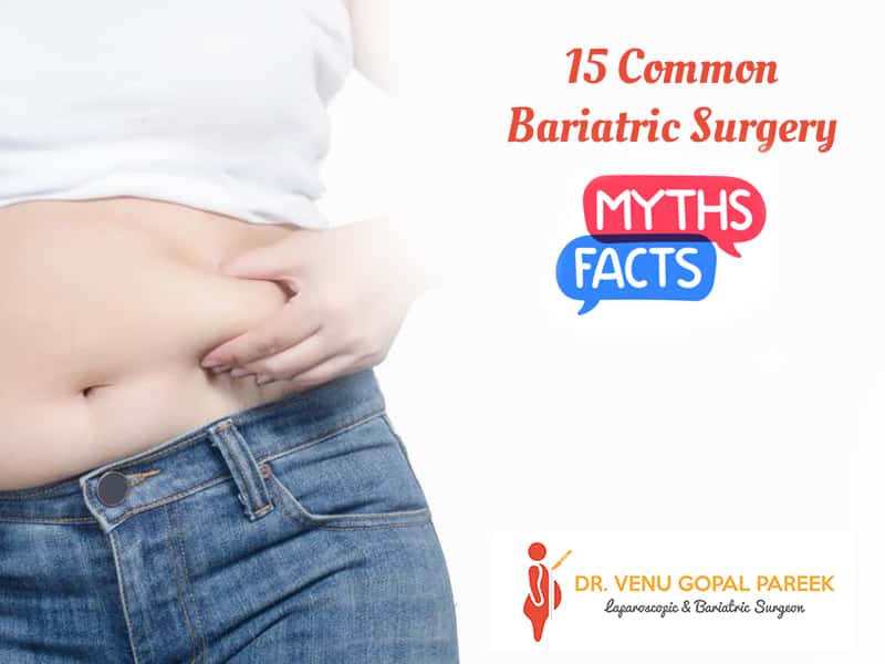 bariatric-surgery-myths&-facts_drvpareek