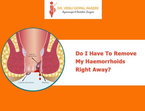 Consultant Dr Venugopal Pareek,One of the best Advanced Laparoscopic and Bariatric surgeon near me hyderabad for hemorrhoid treatment